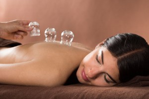 Chinese Medicine and cupping
